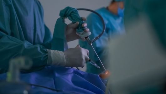 advanced laparoscopic & minimally invasive surgery