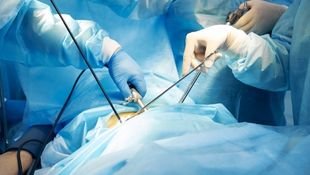 fibroid & endometriosis surgery